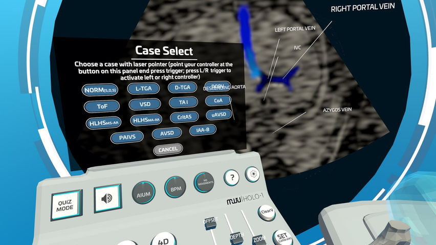 Fetal Heart VR