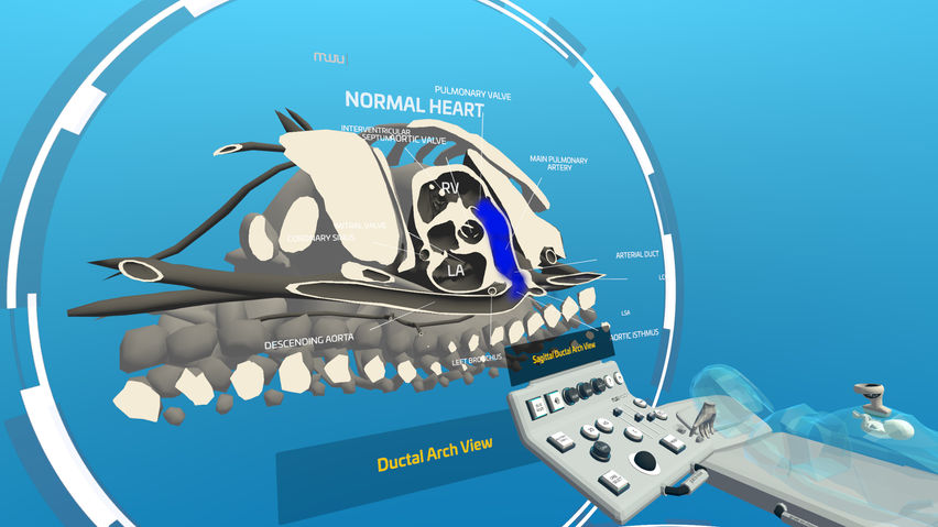 Fetal Heart VR